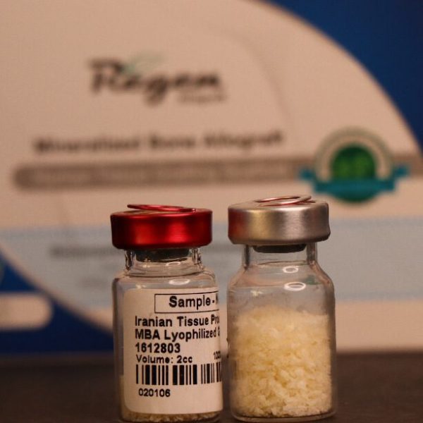 Allograft-Processing05-01-1-600x600.jpg